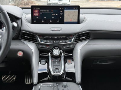 2025 Acura TLX A-Spec Package SH-AWD